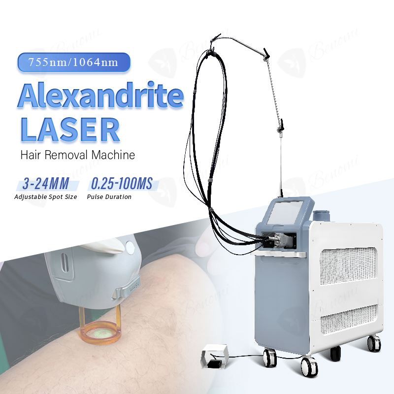 Candela Lazer Alexandrit Epilasyon Sistemi|Tüm cilt tipleri için çift dalga boyu 755nm +1064 nm